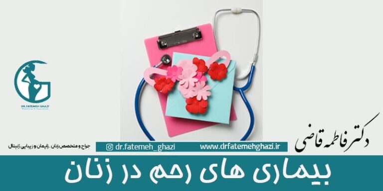 بیماری های رحم در زنان